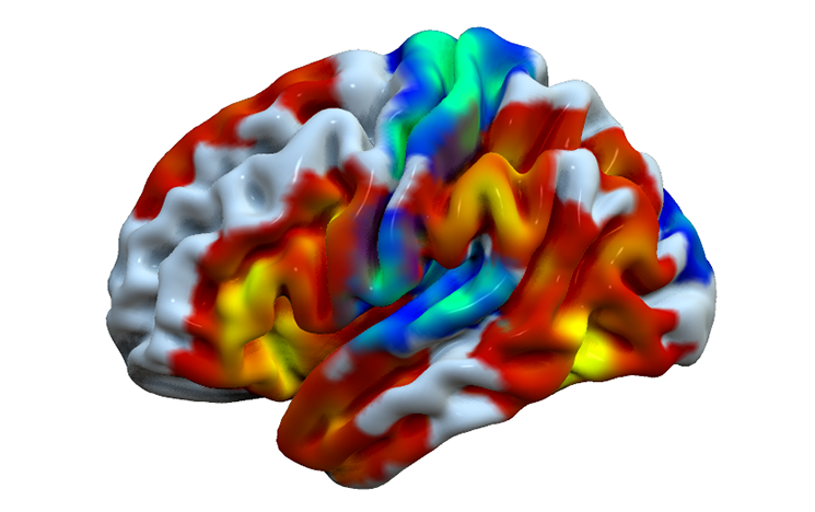 Model of a human brain. Colours show the brain is feeling surprised.